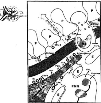 Abb. 5: Mechanismen der chronischen Gewebsschädigung: ein Ausschnitt aus einem Glomerulus (links) zeigt den Übergang von dem akuten in den chronischen Gewebsschaden (rechts) durch Autoantikörper bzw