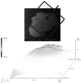 Abb. 1: Elektronenmikroskopische und topo-graphische  A u f n a h m e des Titanabriebs auf einem einfach luxierten  keramischen Hüftendoprothesenkopf