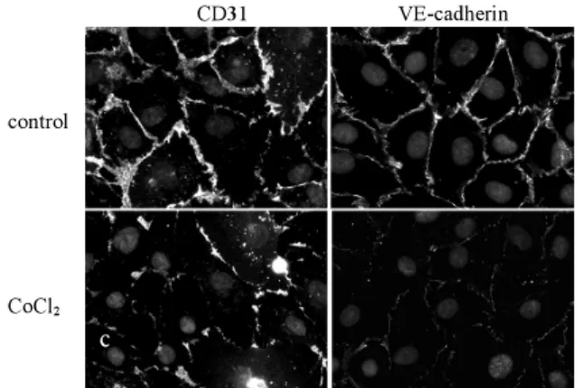 Figure 1: Staining for CD31 (a/c) and VE-cadherin (b/d) in HDMEC. a/b: untreated control c/d: CoCl 2 -treatment