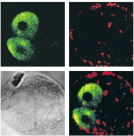 Abbildung 3 β -Zelle: Glucokinase (grün), das  geschwindigkeits-bestimmende Enzym des Glucosestoffwechsels der  β -Zelle, ist perinukleär lokalisiert während  Insulin-granula (rot) in der  Periphe-rie der  β -Zelle angereichert zu finden sind