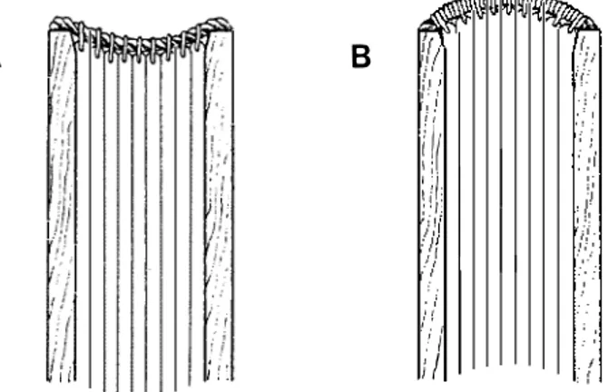 Abb.  6:  Schematische Darstellung der Auswölbung des Buchrückens bei einfacher Heftung mit ungenü­