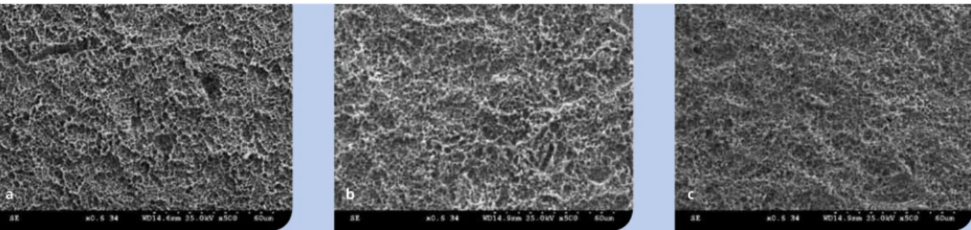 Abb.  3a,  b,  c:  Rasterelektronenmikroskopische  Aufnahmen  in  500-facher  Vergrößerung  einer  nativen  SLA-Oberfläche  (a)  sowie  von  SLA- SLA-Oberflächen nach 48 Stunden intraoraler Biofilmsammlung mit anschließender Dekontamination (b, c)