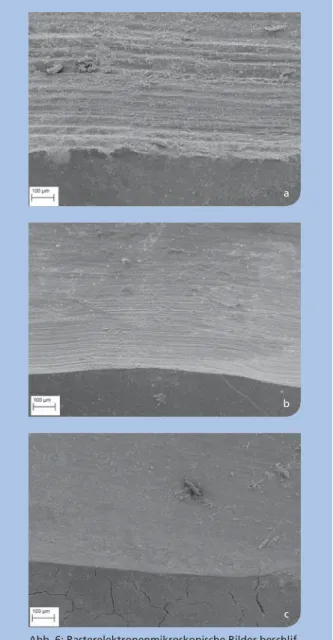 Abb. 6: Rasterelektronenmikroskopische Bilder beschlif- beschlif-fener natürlicher Zähne: Oberflächenqualität und  Präpa-rationsgrenze 