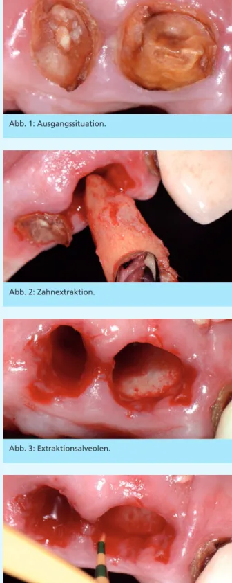 Abb. 1: Ausgangssituation. 