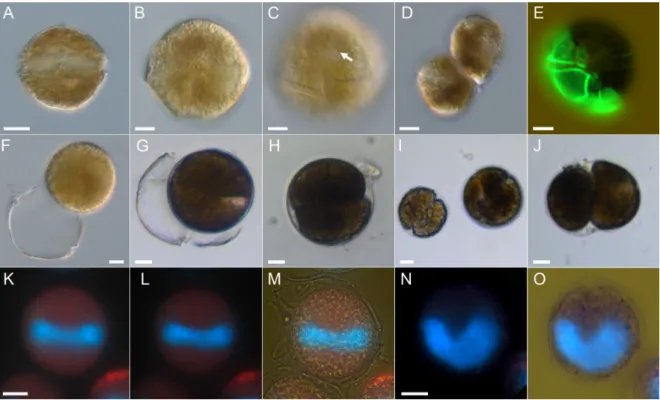 Figure 2. Alexandrium taylorii AY7T, LM micrographs of living (A–D,F–J) or fixed (E,K–O) cells