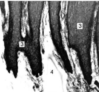 Abb. 17: Der nagelartige Übergang von der oberen Hautschicht Nr. 3  (Stratum spinosum) zur mittleren Hautschicht Nr