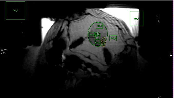 Figure 4-6 Example of an axial FLASH scan in vivo with marked ROIs for the evaluation of blood flow