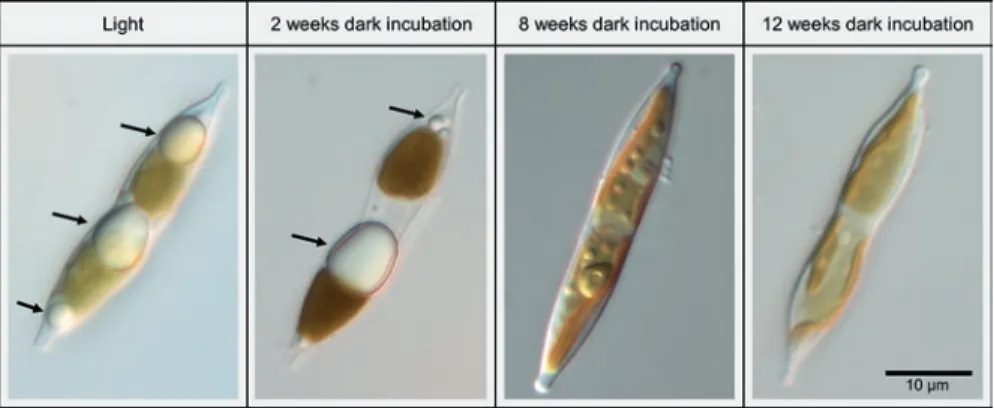 Fig. 8.3  Cells of the benthic diatom Nitzschia cf. dubiiformis from Adventfjorden, Svalbard,  grown under light conditions (late log phase) and after 2, 8 and 12 weeks of darkness