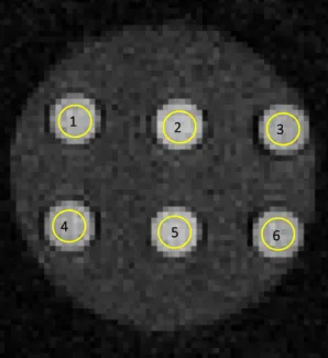 Figure  13:MR  image  of  a  phantom  with  a  different  pH  value (6.5; 6.8; 7.0; 7.2; 7.5; 7.8) in each tube