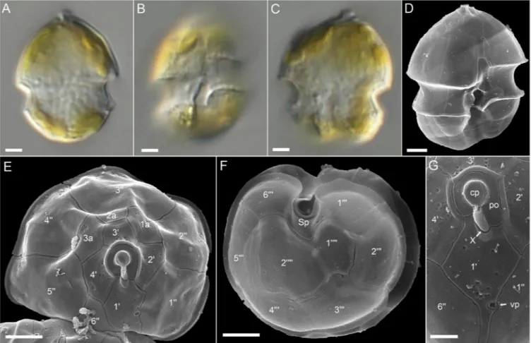 Fig. 6. Light and scanning electron micrographs of Azadinium obesum (strain LF-44-C03)