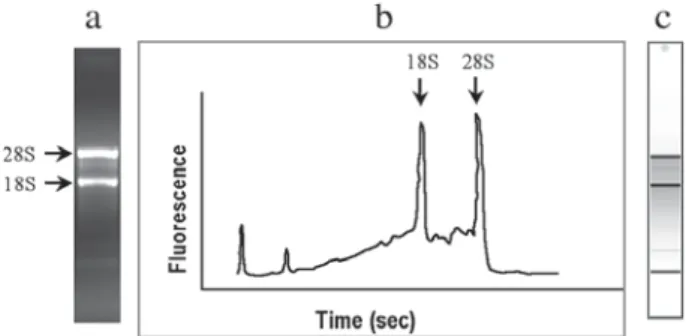 Fig. 2: Qualitative analysis of total RNA extracted from tardigrades. a)  28S and 18S rRNA separated by agarose gel electrophoresis (150 ng total  RNA loaded)