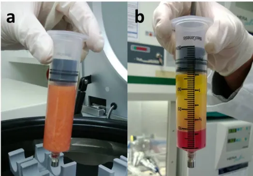 Figure 9 Digested tissue before (a) and after centrifugation (b). The content is separated into  an upper oil layer, a layer of tumescent, blood and a small SVF pellet at the bottom
