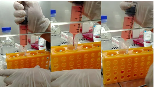 Figure  10  Transferring  the  SVF  into  a  50ml  centrifugation  tube.  The  SVF  is  evident  as  a  small red pellet at the bottom of the syringe and is released with the lower 5ml of PBS