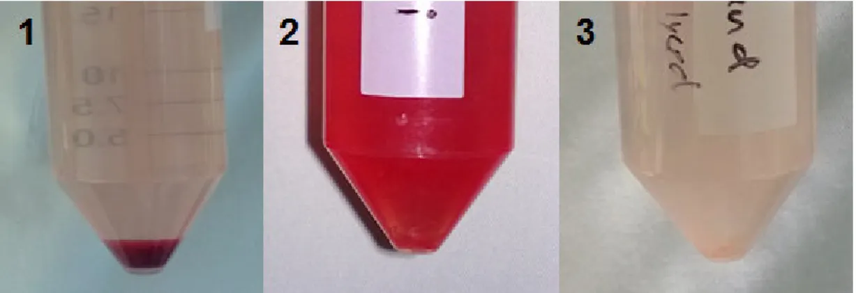 Figure 11 Deep red color of the SVF pellet in PBS after isolation (1). Re-suspended pellet in  erythrocyte lysis buffer (2)