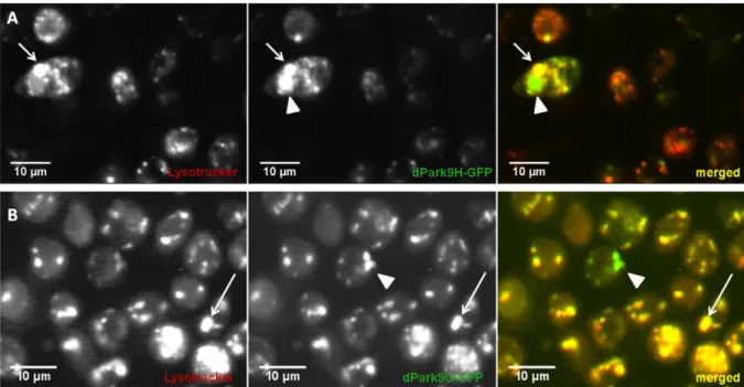 Abbildung  15:  Lokalisation  von  dPark9H-  und  dPark9H-GFP  in  S2-Zellen.  Es  ist  eine  Kolokalisation  von  dPark9H-GFP  (A)  und  dPark9G-GFP  (B)  mit  der  Lysotrackerfärbung  zu  beobachten  (Pfeile)