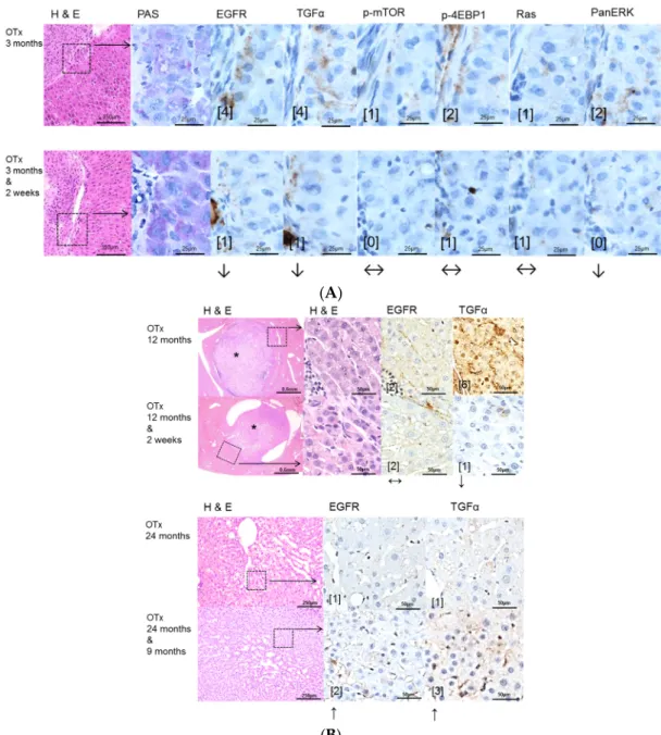 Figure 3. Effects of Gefitinib after intraportal transplantation of ovarian fragments in ovariectomized  rats (OTX) and expression patterns of EGFR, TGFα and downstream signaling pathways in  pre-neoplastic foci of altered hepatocytes (FAH) and neoplastic 