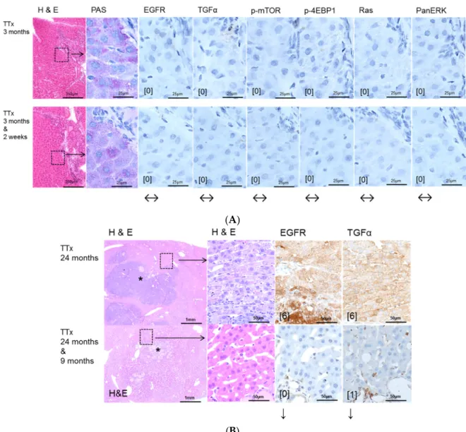 Figure 4. Effects of Gefitinib at three months after intraportal transplantation of thyroid follicles  fragments in thyroidectomized rats (TTx) and expression patterns of EGFR and TGFα and  downstream signaling pathways in pre-neoplastic foci of altered he