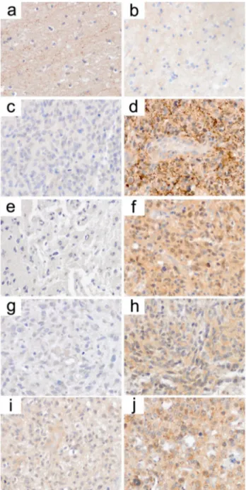 Figure 3: Immunohistochemistry states reactivation  of slc transporter expression in patients’ biopsy  samples under VPA treatment