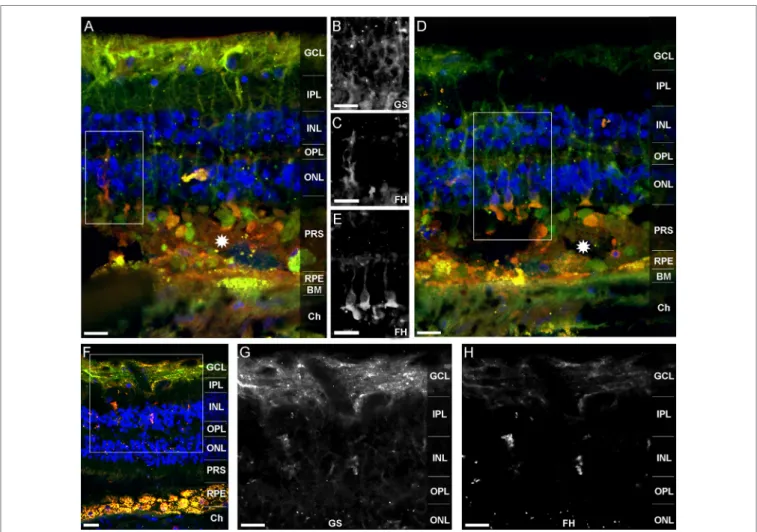 FigUre 6 | Fh is localized in human Müller cells and photoreceptor cell segments. FH (orange a,D,F) colocalized with different cellular sub-compartments  of retinal Müller glia (green a,D,F)