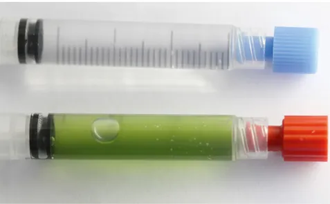 Abb. 1: Eine Blase hat sich nur in der  Spritze mit Mikroalgen (unten) gebildet. 