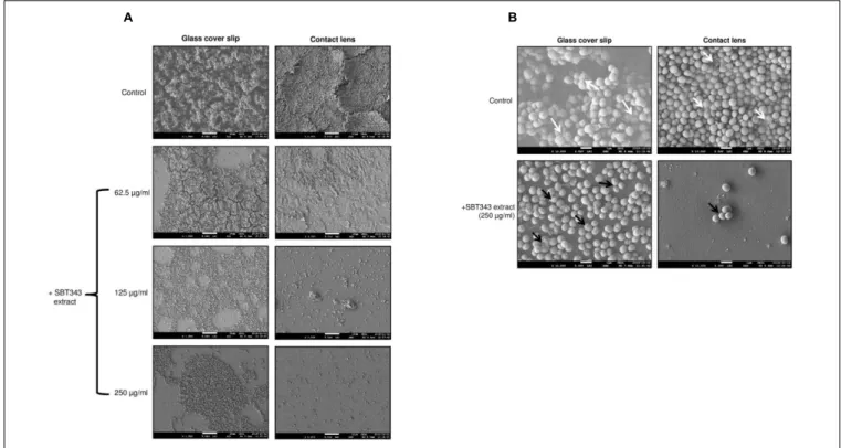 FIGURE 3 | Confocal laser scanning microscopy analyses of staphylococcal biofilm in the presence of the SBT343 extract, visualized by