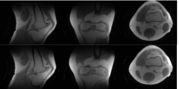 Figure 3.4. Upper images: knee scan without rewinder. Lower images: knee scan  with rewinder