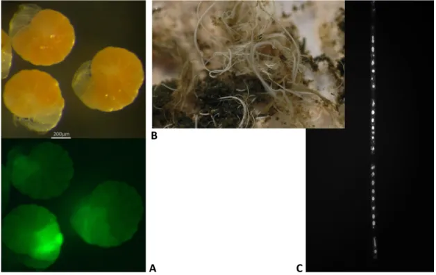 Abb. 2: A Foraminiferen bei Auf- und Fluoreszenslicht; B. Eng verwobene Filamente von  Marithioploca und Beggiatoa mit Sedimentpartikeln kurz nach der Beprobung des Landers