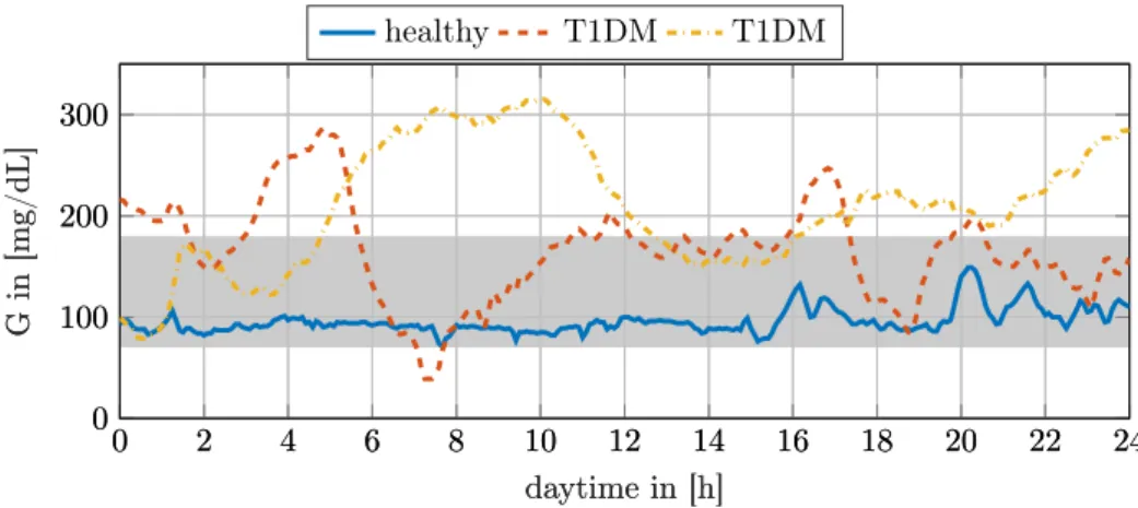 Figure 1.1: Three different glucose profiles over the course of a day. The raw data from the CGM is shown here
