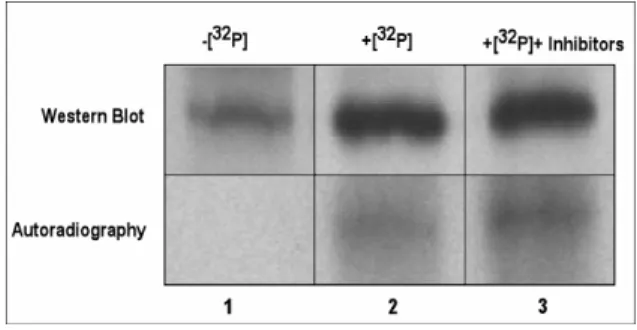 Figure 8.  In vivo phosphorylation of  GAPR-1. Confluent CHO wt cells were  incubated for 4 hrs in DMEM medium  (phosphate and serum free) at 37 o C in the  absence (lane 1) or presence (lanes 2 and  3) of [ 32 P] 0.25mCi/ml