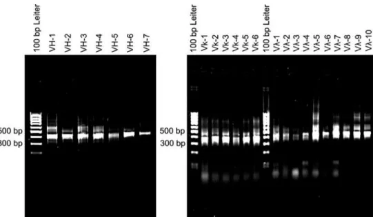 Abb. 4: PCR-Produkte der Reamplifikation der VH-, VLκ ) - und VLλ * -Gene der Patientin S