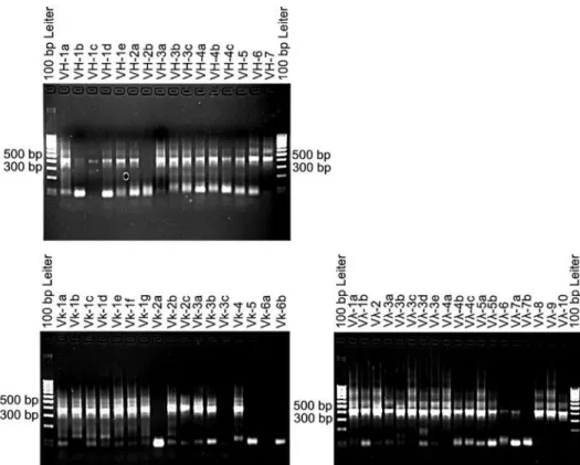 Abb. 5: PCR-Produkte der Reamplifikation der VH-, VLκ - - und VLλ . -Gene von sechs  Patientinnen