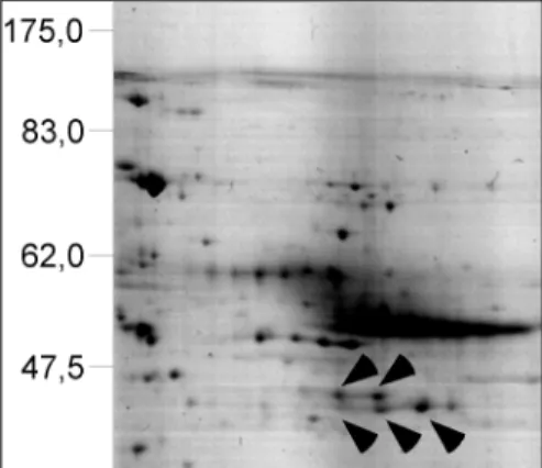 Abb. 11 2D-Gelektrophorese Snail-assoziierter Proteine: