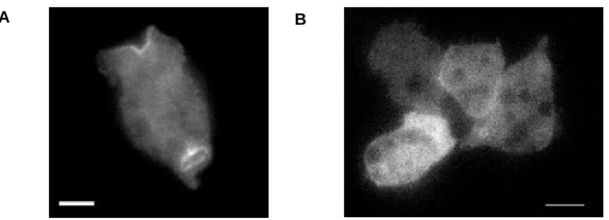 Abbildung 4.3:  Lokalisierung von YFP-MyoD. Gezeigt sind Epifluoreszenzaufnahmen lebender Zellen, die  YFP -MyoD exprimieren