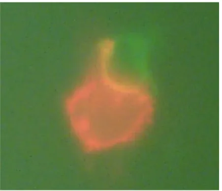 Abbildung 17: Beginnende Phagozytose im Fluoreszenzmikroskop  (Makrophage orange, Lymphozyt grün angefärbt) 