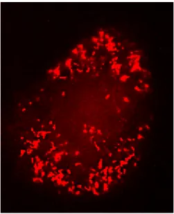Abb. 6-3 : Überexpression von Pex11-1-YFP in CHO-Zellen erzeugt in Gegenwart von 10 ug/ml Nocodazol keine Cluster mehr: In einem Drittel der transfizierten Zellen wurden ohne Inhibitor-Einfluß große Cluster ausgebildet (Abb