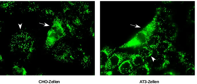 Abb. 9 : GFP-Pex11-2 induziert peroxisomale Aggregation (Clustering) in Säugerzellen: Die linke Abbildung zeigt einen stabil exprimierenden selektionierten CHO-Zellklon, in der rechten Abbildung ist eine mikroinjizierte AT3-Zelle zu sehen (16h Expression)
