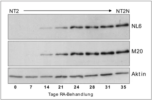 Abb. 3.2: Immunblot-Analyse der NF-M Expression während der  Differenzierung von NT2 Zellen