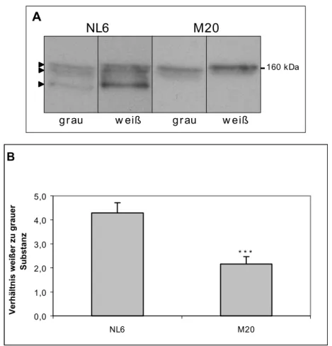 Abb. 3.8: Verteilung von NL6 Antigen zu Gesamt-NF-M in humanen Cortex. Temporallappengewebe von  fünf Patienten wurde in weiße und graue Substanz getrennt, am Kryostat geschnitten und dann mit RIPA-Puffer  lysiert