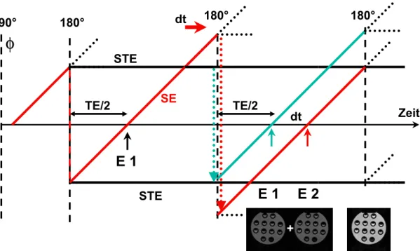 Abb. 3.5: Phasendiagramm der SPLICE-HASTE Bildgebungstechnik zur  Akquisition diffusionsgewichteter Bilder und Darstellung der Echoentstehung