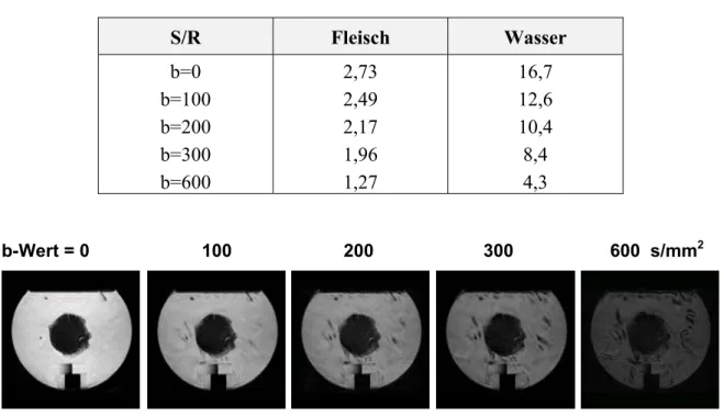 Tab. 4.8: Signal-Rauschverhältnisse für Muskelfleisch und Wasser aus einer ROI  im Objekt aus Abbildung 4.7 für die SPLICE-HASTE Sequenz (TE=116 ms)
