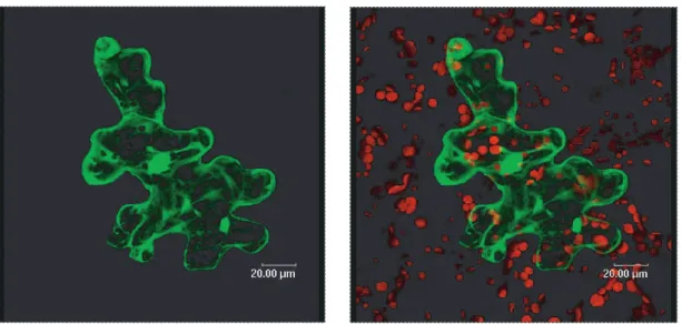 Abbildung 3.14.: Kontrollplasmid pA7Bi35S-GFP in einer Arabidopsis thaliana Epidermiszelle