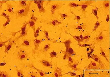 Abb. 2.1: C. albicans in Mikroglia-Zellen. Mikroglia-Zellen wurden mit C. albicans inkubiert und nach dem  Standardprotokoll gefärbt