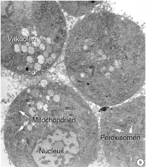Abbildung 3.3.2-7-9: Ultrastruktur von isolierten Hepatocyten aus der Regenbogenforelle 2 Stunden nach einer 10 minütigen Bestrahlung mit ultraviolettem Licht