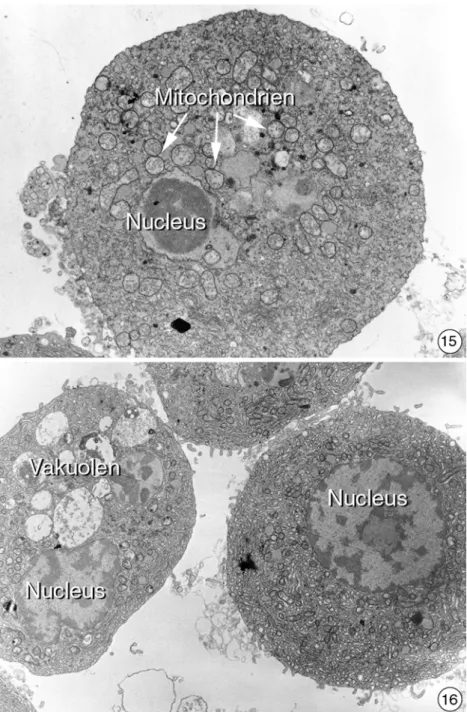 Abbildung 3.3.2-13 bis 16: Ultrastruktur von isolierten Hepatocyten aus der Regenbogenfo- Regenbogenfo-relle 6 Stunden nach einer 10 minütigen Bestrahlung mit ultraviolettem Licht
