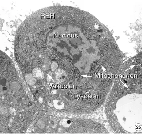 Abbildung 3.3.2-23 bis 25: Ultrastruktur von isolierten Hepatocyten aus der Regenbogenfo- Regenbogenfo-relle 22 Stunden nach Bestrahlung mit ultraviolettem Licht für 10 Minuten
