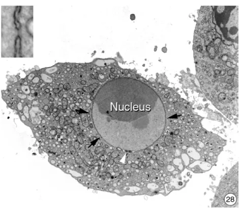 Abbildung 3.3.2-26 bis 28: Ultrastruktur von isolierten Hepatocyten aus der Regenbogenfo- Regenbogenfo-relle 24 Stunden nach einer Bestrahlung mit ultraviolettem Licht für 10 Minuten