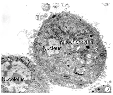 Abbildung 3.3.2-1 bis 3: Ultrastruktur von isolierten Hepatocyten aus der Regenbogen- Regenbogen-forelle 24 Stunden nach der Isolation (1 bis 3) und direkt nach einer Bestrahlung mit  ultravi-olettem Licht für 10 Minuten