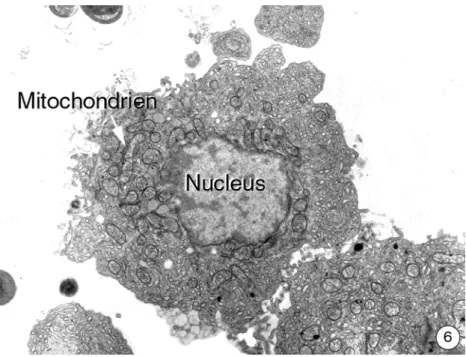 Abbildung 3.3.2-4 bis 6: Ultrastruktur von isolierten Hepatocyten aus der Regenbogenforelle direkt nach einer Bestrahlung mit ultraviolettem Licht für 10 Minuten