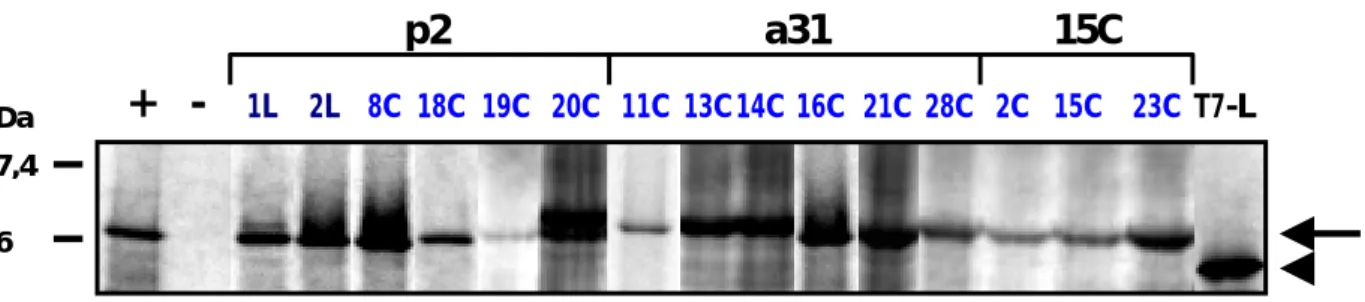 Abbildung 1: Gekoppelte in-vitro-Transkription/Translation der klonierten cDNAs aus den   Tumorzelllinien LX-1 und CX-2 