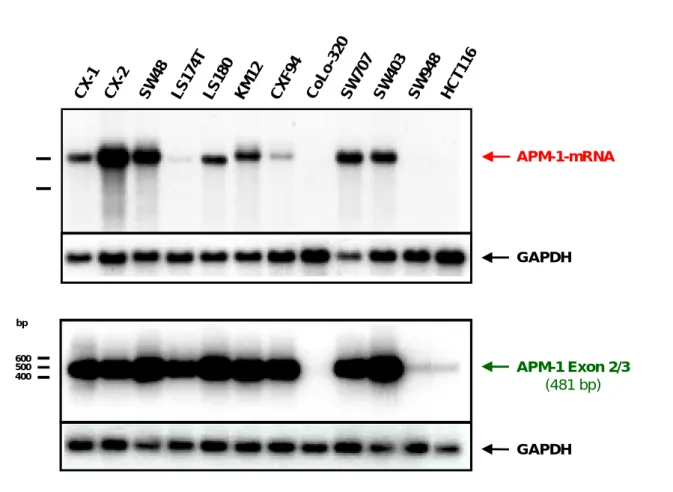 Abbildung 5: Vergleich von Northern-Analyse und RT-PCR-Analyse der APM-1 -Genexpression  in  Colonkarzinom-Zelllinien 